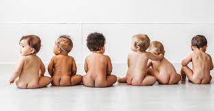 Homeopathic-treatment-for-diaper-rash
