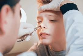 Homeopathic-treatment-for-nasal-polyp