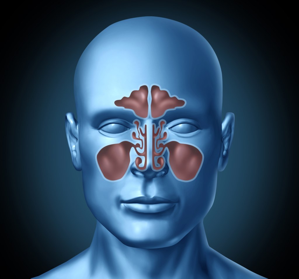 sinusitis - respiratory - health - homeopathy